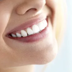 Igiena dentară